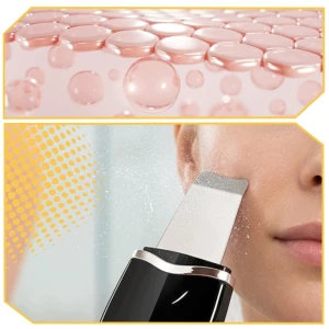 Peeling-Kawitacyjny-urzadzenie-do-oczyszczania-Twarzy-Ultradzwiekowy-5w1-Zasilanie-akumulatorowe-sieciowo-akumulatorowe.jpg
